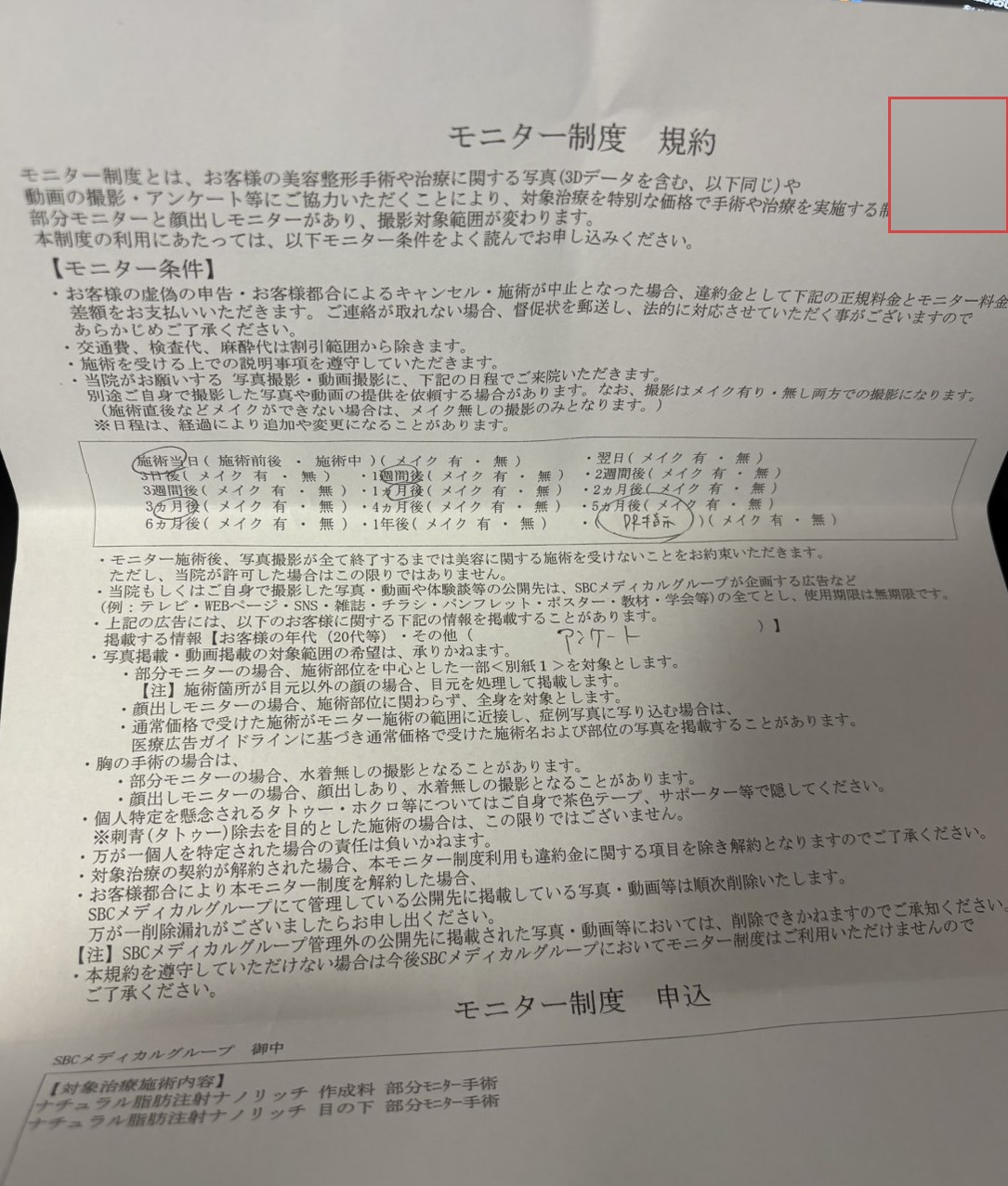 モニター制度規約の書面。撮影のための来院日程の候補が施術当日から 1 年後まで並び、対象治療施術内容としてナチュラル脂肪注射ナノリッチが記載されている