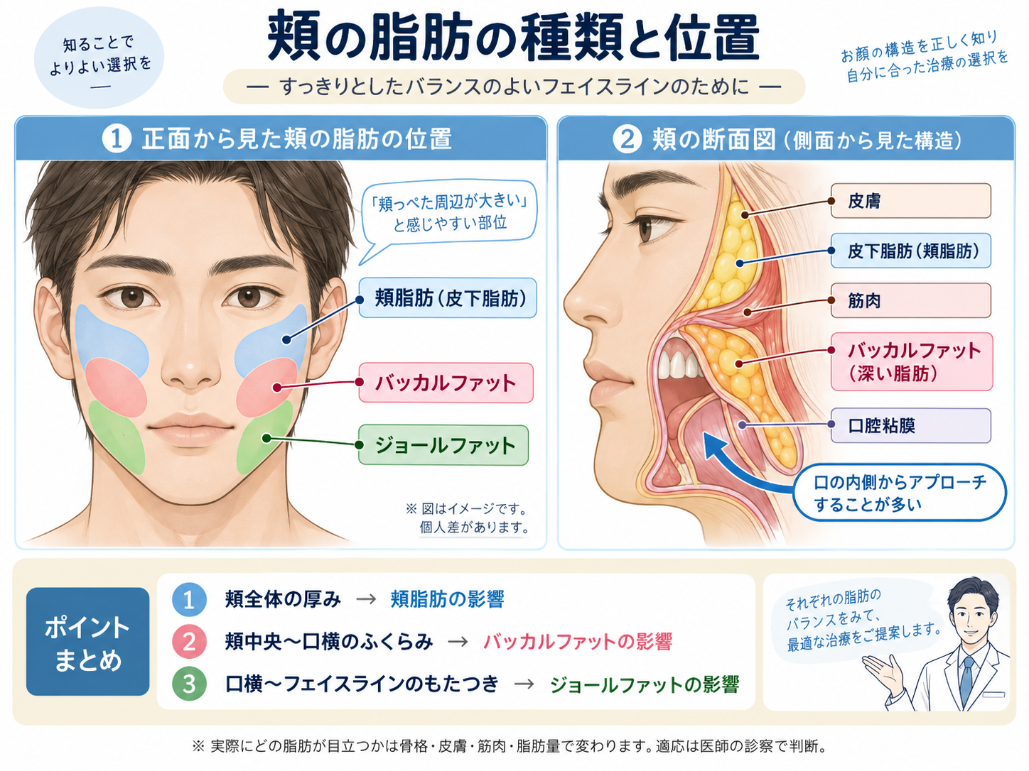 頬の脂肪の種類と位置を示したイメージ図。正面図で頬脂肪、バッカルファット、ジョールファットの位置、断面図で皮膚、皮下脂肪、筋肉、バッカルファット、口腔粘膜の重なりを示している